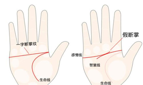断掌纹的孩子有什么说法 双手断掌纹的孩子有什么说法