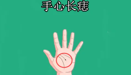 手心有痣的女人是什么命运 手心有痣的女人有什么说法