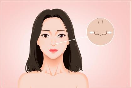 女人外眼角下垂是什么原因，这种面相说明什么？