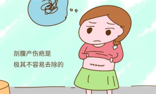 2023年2月剖腹产吉日吉时 2023年剖腹产2月黄道吉日一览表