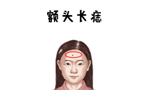 额头有痣的女人有什么寓意 额头有痣的女人面相好不好